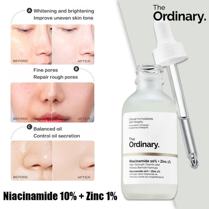 THE ORDINARY Niacinamide 10% + ZINC 1% 30ml - AB Trader